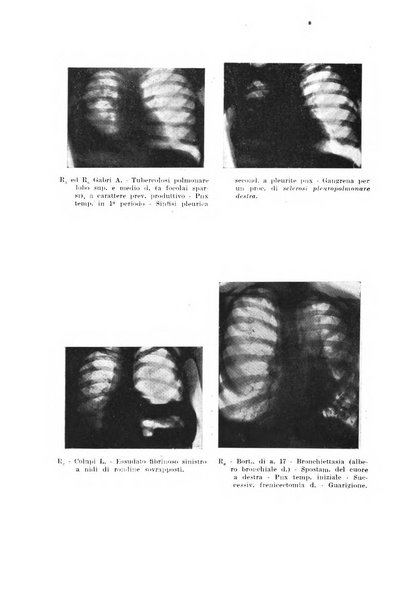 Tubercolosi giornale di studi e di lotta antitubercolare