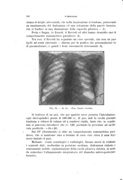 Tubercolosi giornale di studi e di lotta antitubercolare