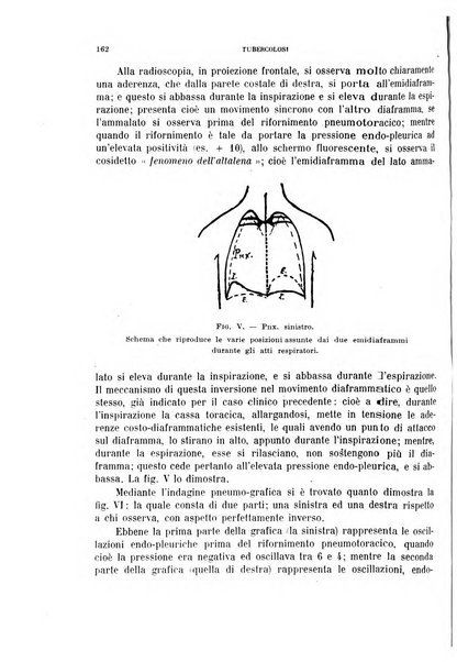 Tubercolosi giornale di studi e di lotta antitubercolare