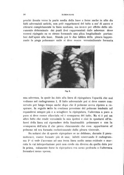 Tubercolosi giornale di studi e di lotta antitubercolare