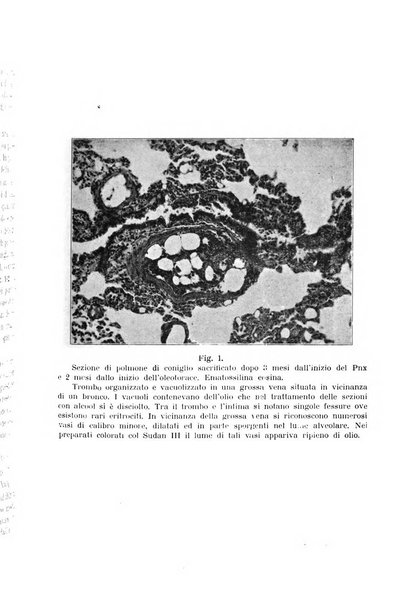 Tubercolosi giornale di studi e di lotta antitubercolare