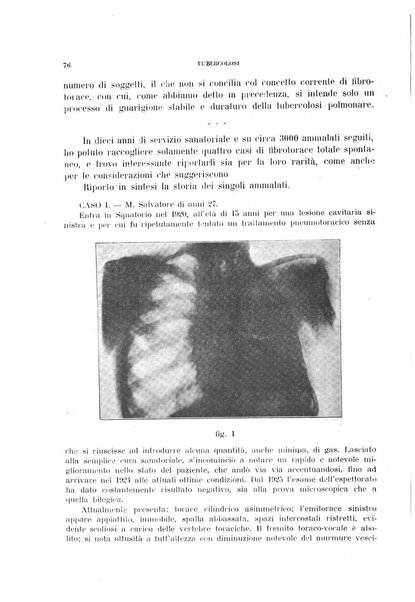 Tubercolosi giornale di studi e di lotta antitubercolare