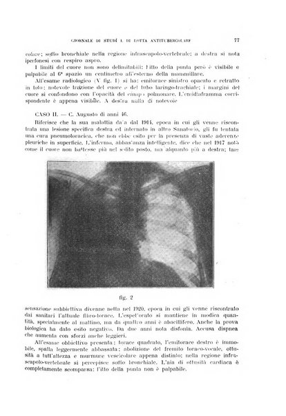 Tubercolosi giornale di studi e di lotta antitubercolare