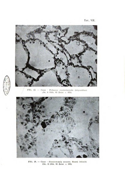 Tubercolosi giornale di studi e di lotta antitubercolare