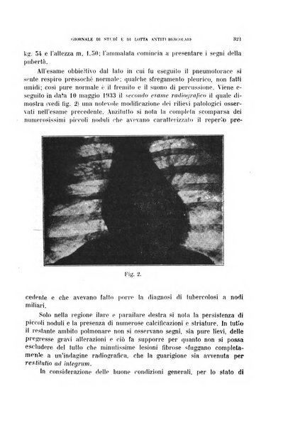 Tubercolosi giornale di studi e di lotta antitubercolare