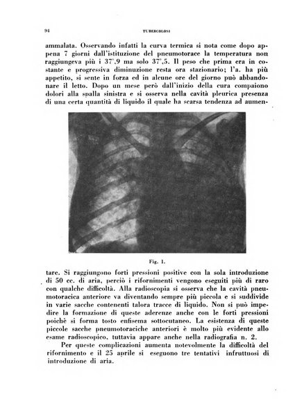 Tubercolosi giornale di studi e di lotta antitubercolare