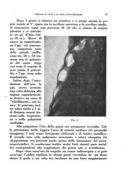 Tubercolosi giornale di studi e di lotta antitubercolare