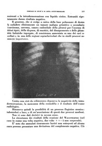 Tubercolosi giornale di studi e di lotta antitubercolare