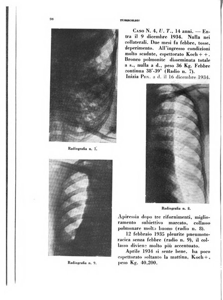 Tubercolosi giornale di studi e di lotta antitubercolare