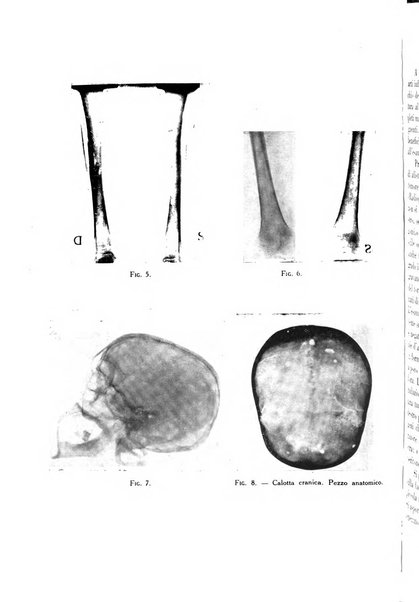 Tubercolosi giornale di studi e di lotta antitubercolare