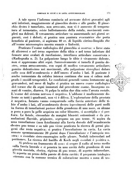 Tubercolosi giornale di studi e di lotta antitubercolare