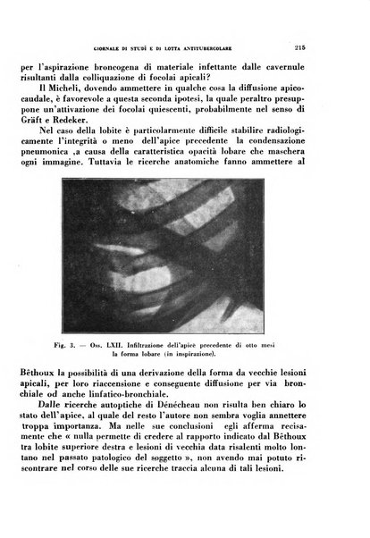 Tubercolosi giornale di studi e di lotta antitubercolare