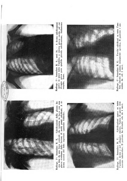 Tubercolosi giornale di studi e di lotta antitubercolare