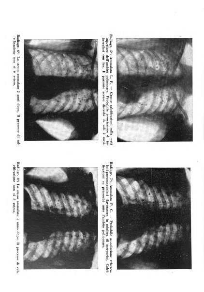 Tubercolosi giornale di studi e di lotta antitubercolare