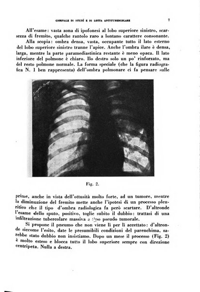 Tubercolosi giornale di studi e di lotta antitubercolare