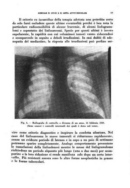 Tubercolosi giornale di studi e di lotta antitubercolare