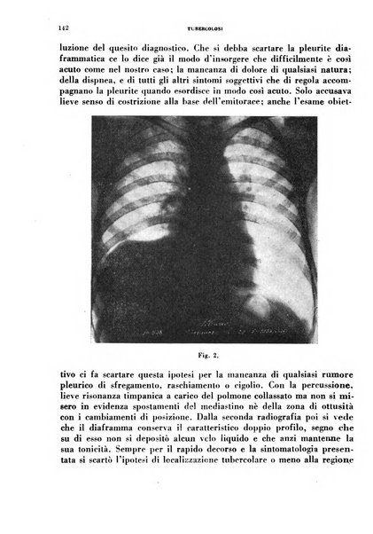 Tubercolosi giornale di studi e di lotta antitubercolare