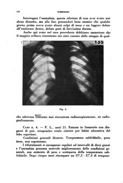 Tubercolosi giornale di studi e di lotta antitubercolare