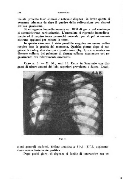 Tubercolosi giornale di studi e di lotta antitubercolare