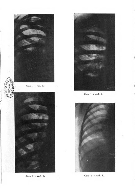 Tubercolosi giornale di studi e di lotta antitubercolare