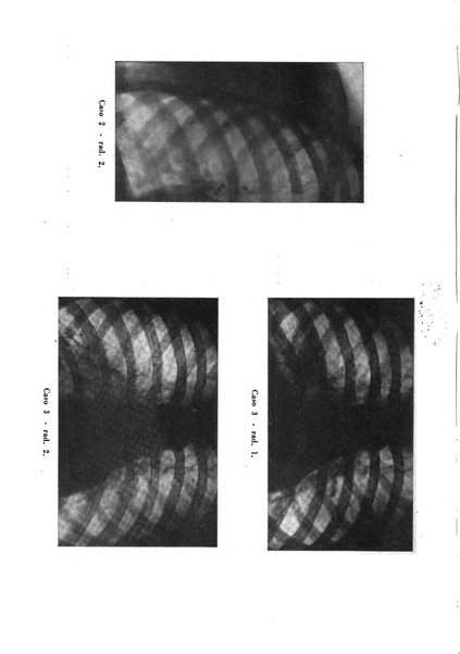 Tubercolosi giornale di studi e di lotta antitubercolare