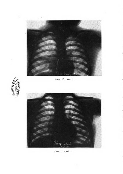 Tubercolosi giornale di studi e di lotta antitubercolare