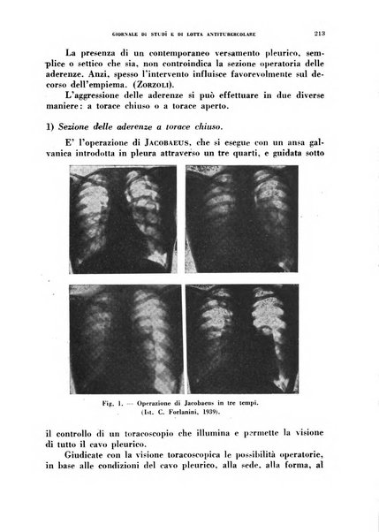 Tubercolosi giornale di studi e di lotta antitubercolare