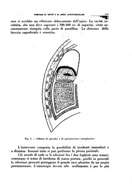 Tubercolosi giornale di studi e di lotta antitubercolare