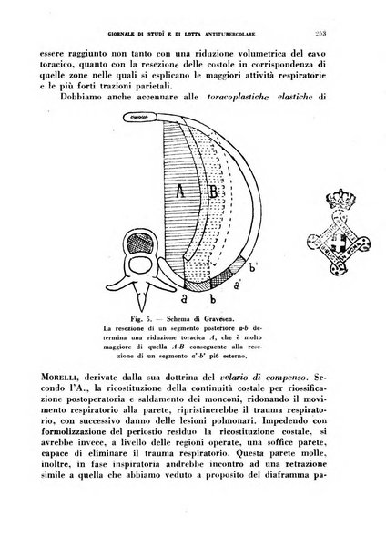 Tubercolosi giornale di studi e di lotta antitubercolare