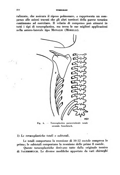 Tubercolosi giornale di studi e di lotta antitubercolare