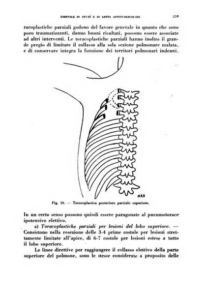 Tubercolosi giornale di studi e di lotta antitubercolare