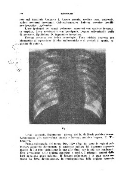 Tubercolosi giornale di studi e di lotta antitubercolare