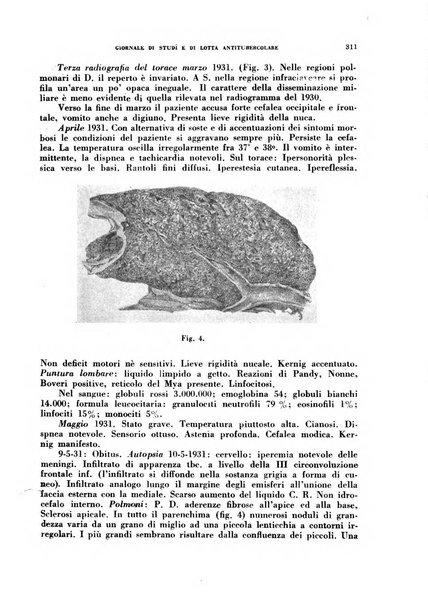 Tubercolosi giornale di studi e di lotta antitubercolare