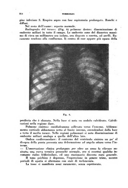 Tubercolosi giornale di studi e di lotta antitubercolare