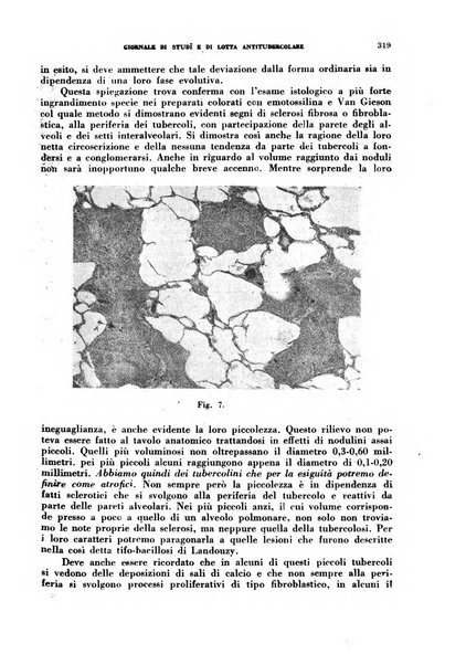 Tubercolosi giornale di studi e di lotta antitubercolare