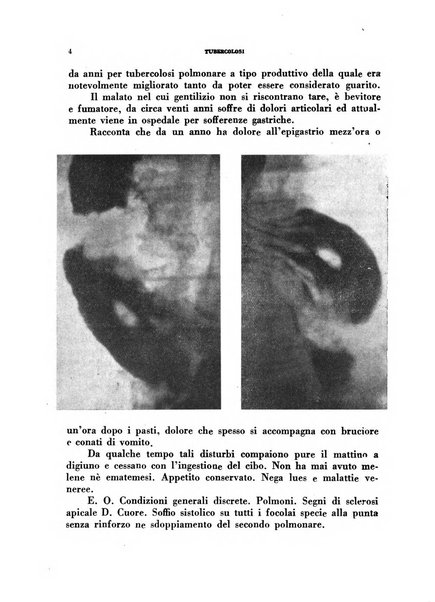 Tubercolosi giornale di studi e di lotta antitubercolare