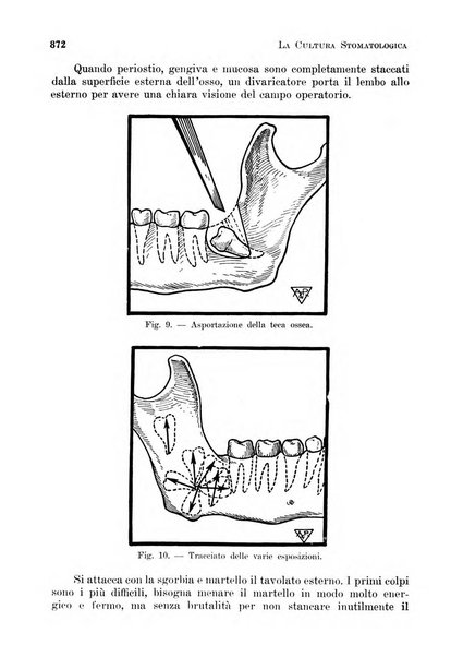 La cultura stomatologica rassegna mensile di scienza, arte, storia e problemi professionali