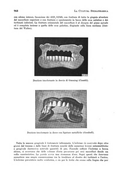 La cultura stomatologica rassegna mensile di scienza, arte, storia e problemi professionali