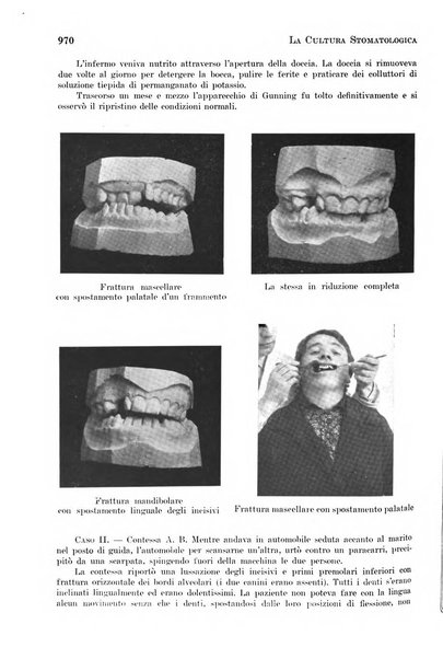 La cultura stomatologica rassegna mensile di scienza, arte, storia e problemi professionali