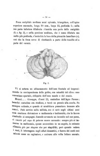 Archivio di psichiatria, scienze penali ed antropologia criminale