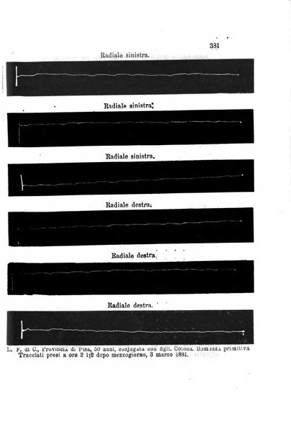 Archivio italiano per le malattie nervose e più particolarmente per le alienazioni mentali organo della Società freniatrica italiana <1874-1891>