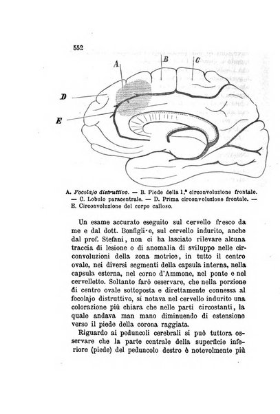 Archivio italiano per le malattie nervose e più particolarmente per le alienazioni mentali organo della Società freniatrica italiana <1874-1891>