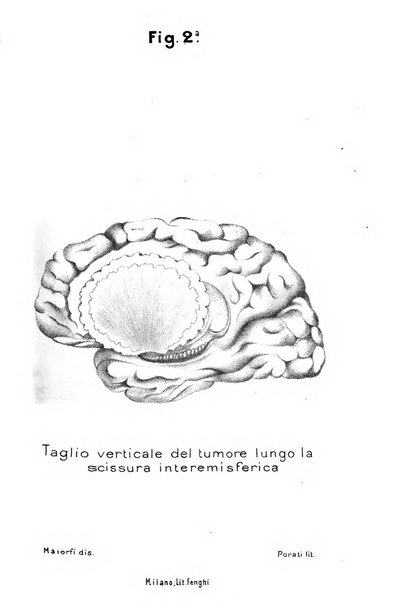 Archivio italiano per le malattie nervose e più particolarmente per le alienazioni mentali organo della Società freniatrica italiana <1874-1891>