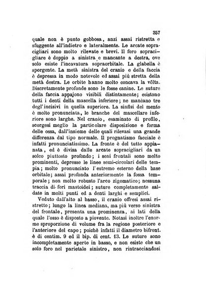 Archivio italiano per le malattie nervose e più particolarmente per le alienazioni mentali organo della Società freniatrica italiana <1874-1891>