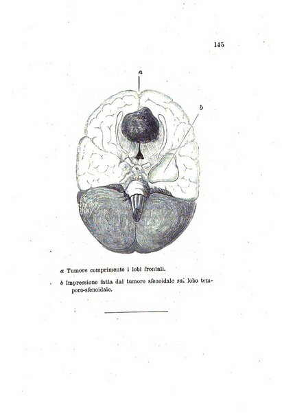 Archivio italiano per le malattie nervose e più particolarmente per le alienazioni mentali organo della Società freniatrica italiana <1874-1891>