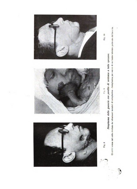 La chirurgia plastica rivista della Societa italiana di chirurgia riparatrice plastica ed estetica