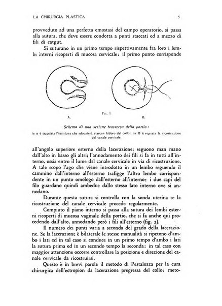 La chirurgia plastica rivista della Societa italiana di chirurgia riparatrice plastica ed estetica