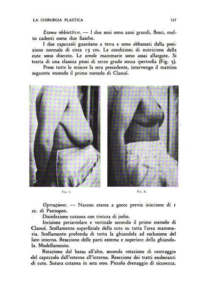 La chirurgia plastica rivista della Societa italiana di chirurgia riparatrice plastica ed estetica