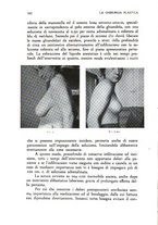giornale/RML0026615/1935/unico/00000180