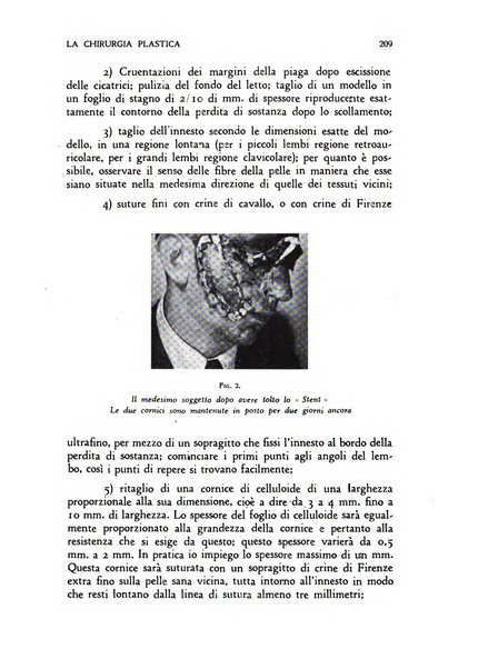 La chirurgia plastica rivista della Societa italiana di chirurgia riparatrice plastica ed estetica